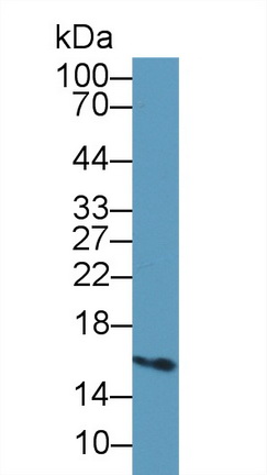 Polyclonal Antibody to Fatty Acid Binding Protein 5 (FABP5)