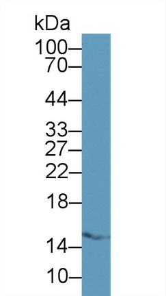 Polyclonal Antibody to Fatty Acid Binding Protein 5 (FABP5)