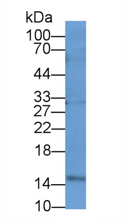 Polyclonal Antibody to Fatty Acid Binding Protein 5 (FABP5)