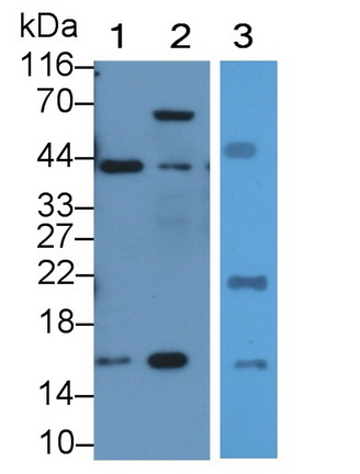 Polyclonal Antibody to Fatty Acid Binding Protein 5 (FABP5)