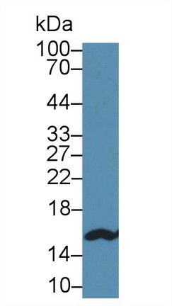 Polyclonal Antibody to Fatty Acid Binding Protein 5 (FABP5)