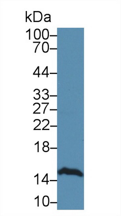 Polyclonal Antibody to Fatty Acid Binding Protein 5 (FABP5)