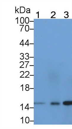 Polyclonal Antibody to Fatty Acid Binding Protein 5 (FABP5)