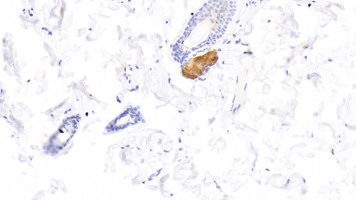 Polyclonal Antibody to Fatty Acid Binding Protein 5 (FABP5)