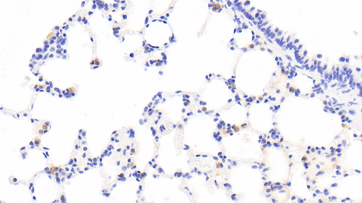 Polyclonal Antibody to Fatty Acid Binding Protein 5 (FABP5)