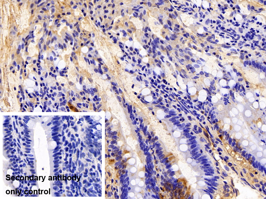 Polyclonal Antibody to Hemopexin (HPX)