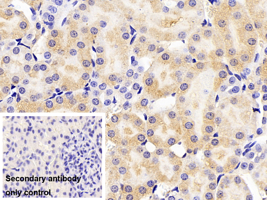 Polyclonal Antibody to Hemopexin (HPX)