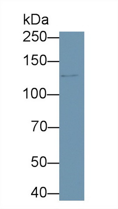 Polyclonal Antibody to Protein Kinase N2 (PKN2)