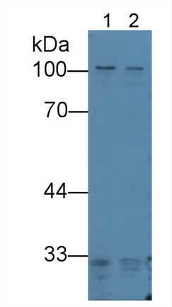 Polyclonal Antibody to Protein Kinase N2 (PKN2)