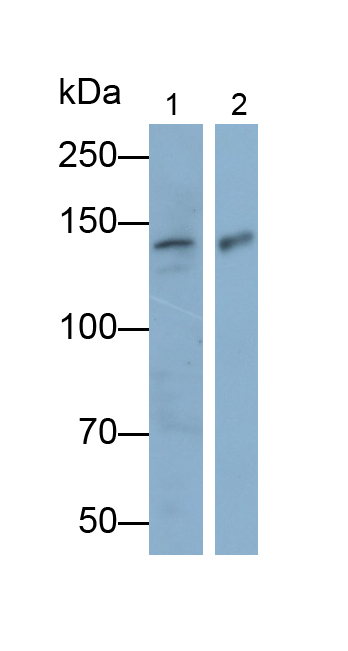 Polyclonal Antibody to Protein Kinase N2 (PKN2)