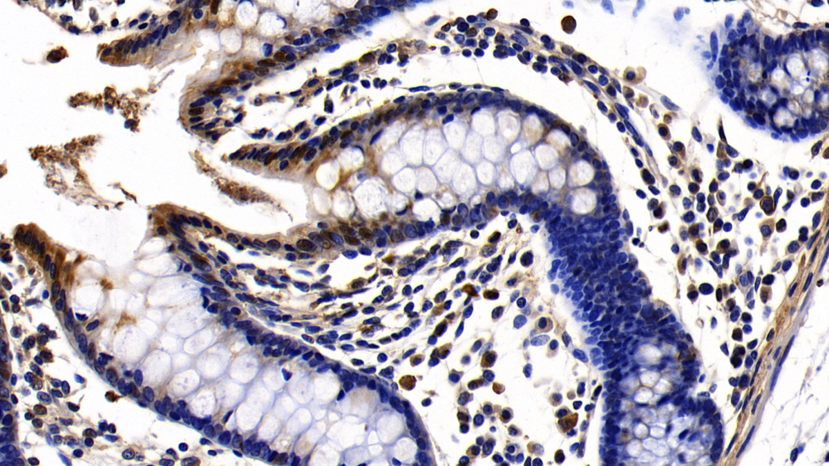 Polyclonal Antibody to Toll Like Receptor 1 (TLR1)