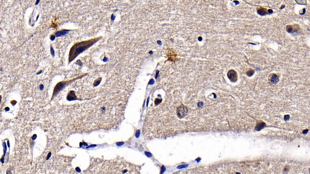 Polyclonal Antibody to Toll Like Receptor 3 (TLR3)