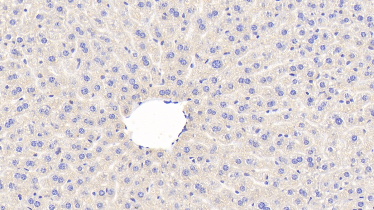 Polyclonal Antibody to Toll Like Receptor 3 (TLR3)