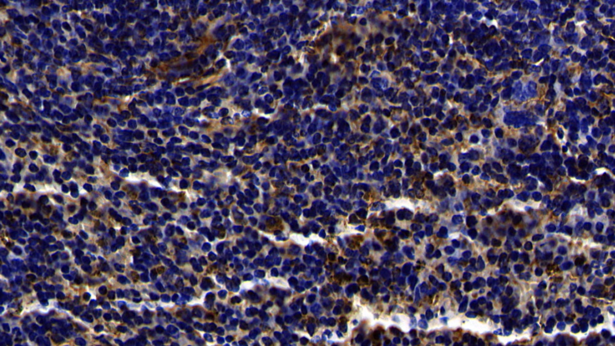 Polyclonal Antibody to Toll Like Receptor 3 (TLR3)