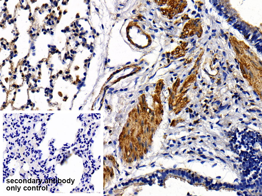 Polyclonal Antibody to Toll Like Receptor 5 (TLR5)