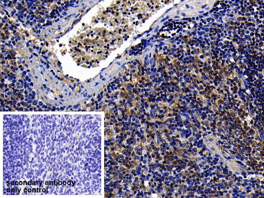 Polyclonal Antibody to Toll Like Receptor 5 (TLR5)