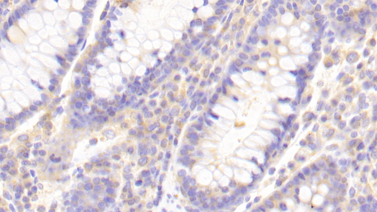 Polyclonal Antibody to Toll Like Receptor 8 (TLR8)