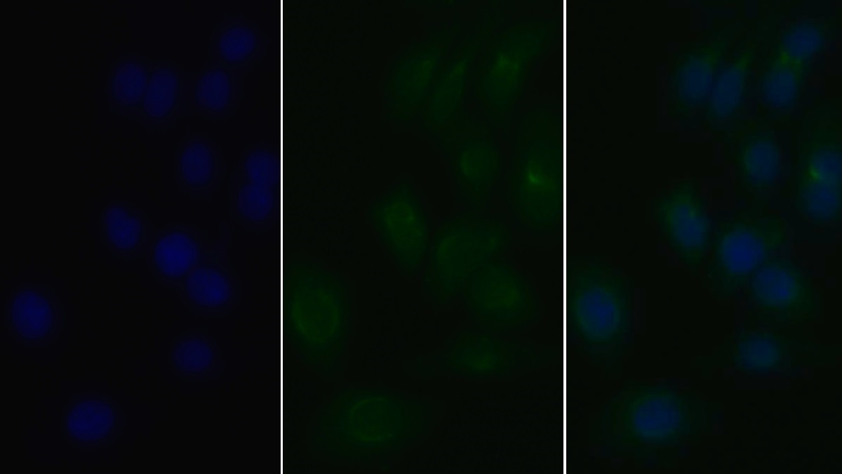 Polyclonal Antibody to Toll Like Receptor 8 (TLR8)