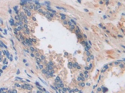 Polyclonal Antibody to Arrestin Beta 1 (ARRb1)