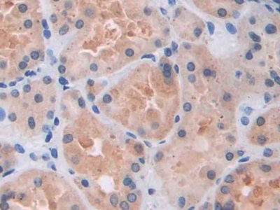 Polyclonal Antibody to Arrestin Beta 1 (ARRb1)