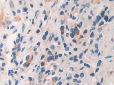 Polyclonal Antibody to Arrestin Beta 1 (ARRb1)