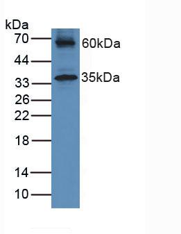 Polyclonal Antibody to Hemojuvelin (HJV)