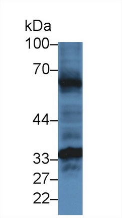 Polyclonal Antibody to Hemojuvelin (HJV)