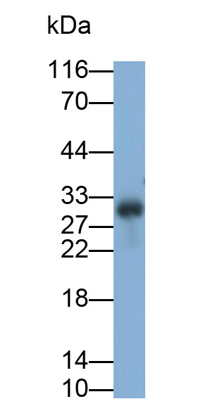 Polyclonal Antibody to Hemojuvelin (HJV)