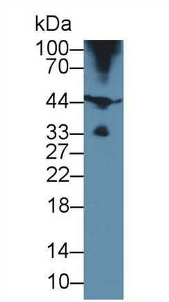 Polyclonal Antibody to Hemojuvelin (HJV)