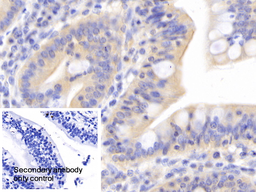 Polyclonal Antibody to Hemojuvelin (HJV)