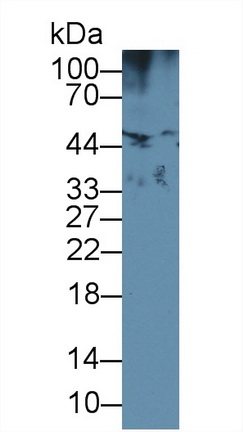 Polyclonal Antibody to Hemojuvelin (HJV)