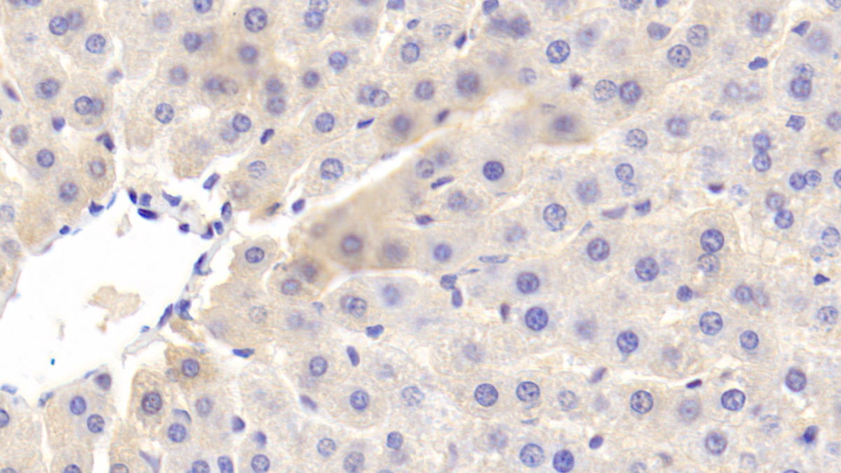 Polyclonal Antibody to Apolipoprotein C2 (APOC2)