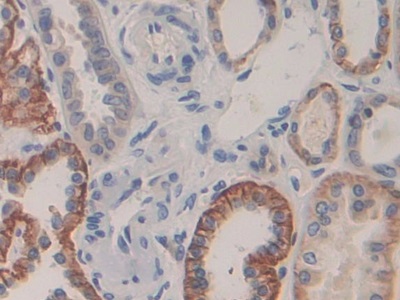 Polyclonal Antibody to Cadherin 16 (CDH16)