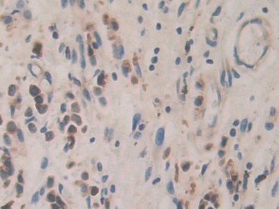 Polyclonal Antibody to Cadherin 16 (CDH16)