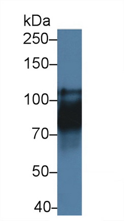 Polyclonal Antibody to Cadherin 16 (CDH16)