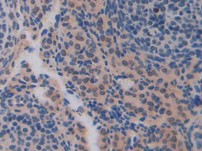 Polyclonal Antibody to Cadherin 16 (CDH16)