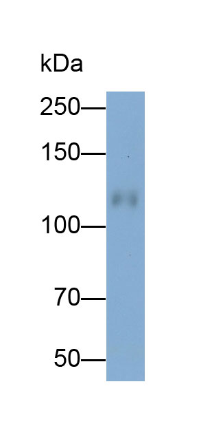 Polyclonal Antibody to Cadherin 16 (CDH16)