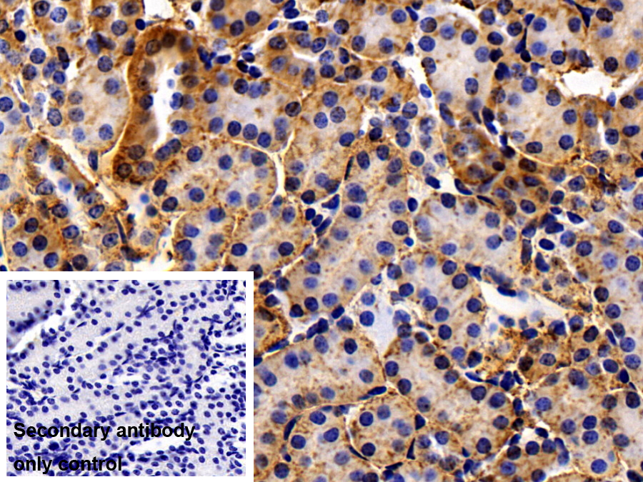 Polyclonal Antibody to Cadherin 16 (CDH16)