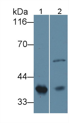 Polyclonal Antibody to Haptoglobin Related Protein (HPR)