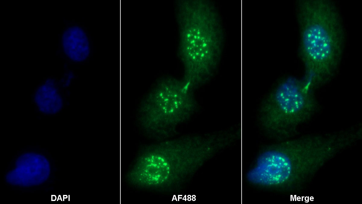 Polyclonal Antibody to Haptoglobin Related Protein (HPR)