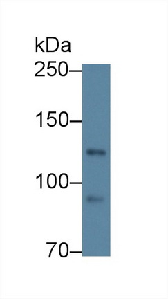 Polyclonal Antibody to Cadherin, Myotubule (CDH15)