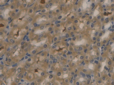 Polyclonal Antibody to Apolipoprotein B (APOB)