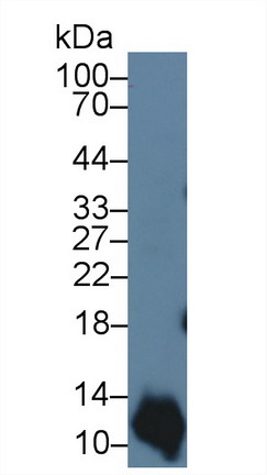 Polyclonal Antibody to S100 Calcium Binding Protein A2 (S100A2)