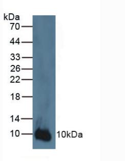 Polyclonal Antibody to S100 Calcium Binding Protein A2 (S100A2)