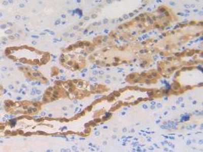 Polyclonal Antibody to S100 Calcium Binding Protein A2 (S100A2)