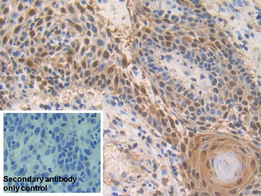 Polyclonal Antibody to S100 Calcium Binding Protein A2 (S100A2)