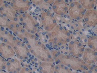 Polyclonal Antibody to Serpin A10 (SERPINA10)