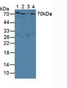 Polyclonal Antibody to Serpin A10 (SERPINA10)