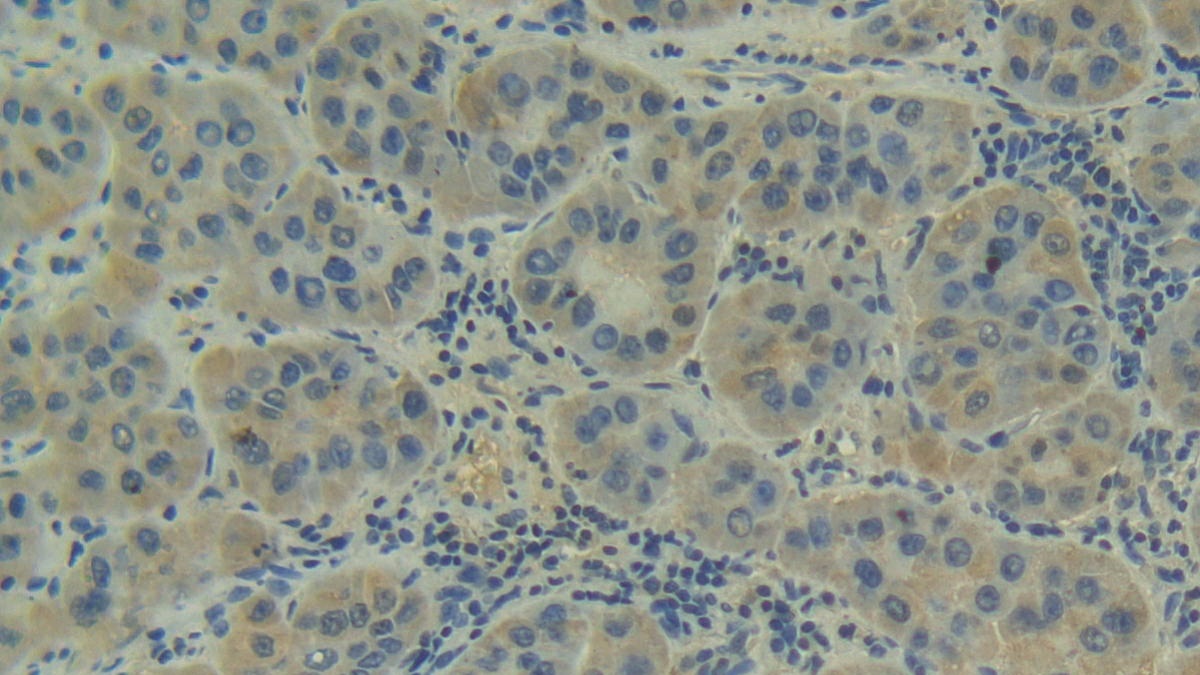 Polyclonal Antibody to Complement Factor B (CFB)