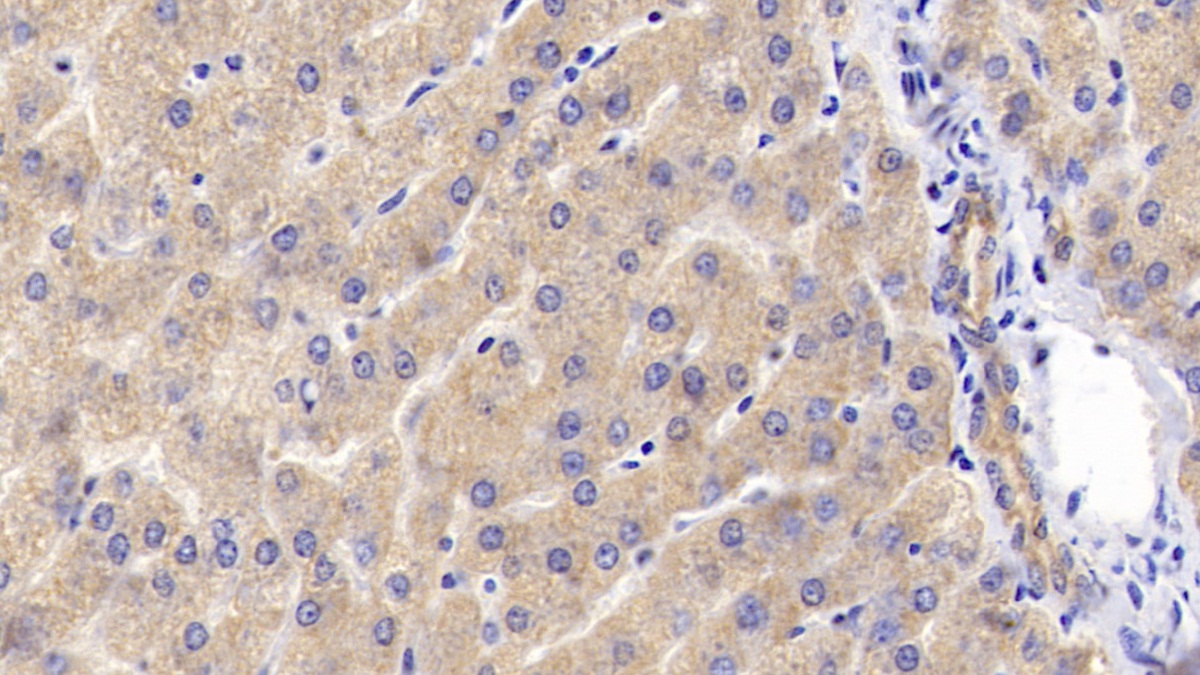 Polyclonal Antibody to Complement Factor B (CFB)